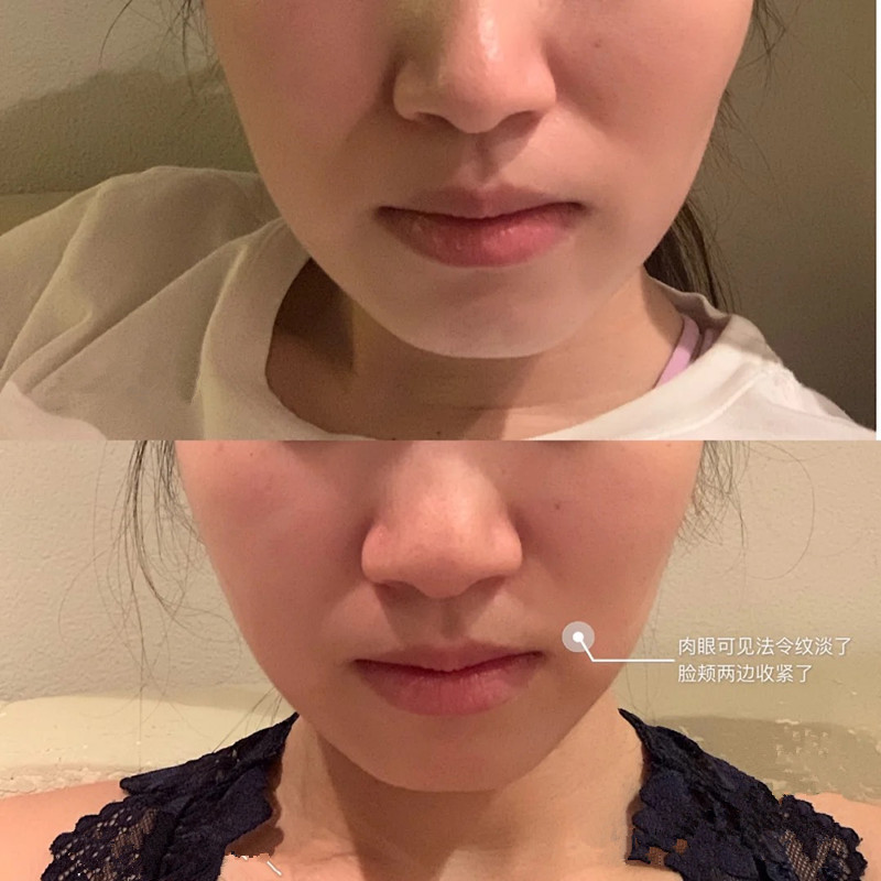 硬核亢老原料 Pro-xylane玻色因富勒烯紫米精华 赋活紧塑丰盈淡纹 3