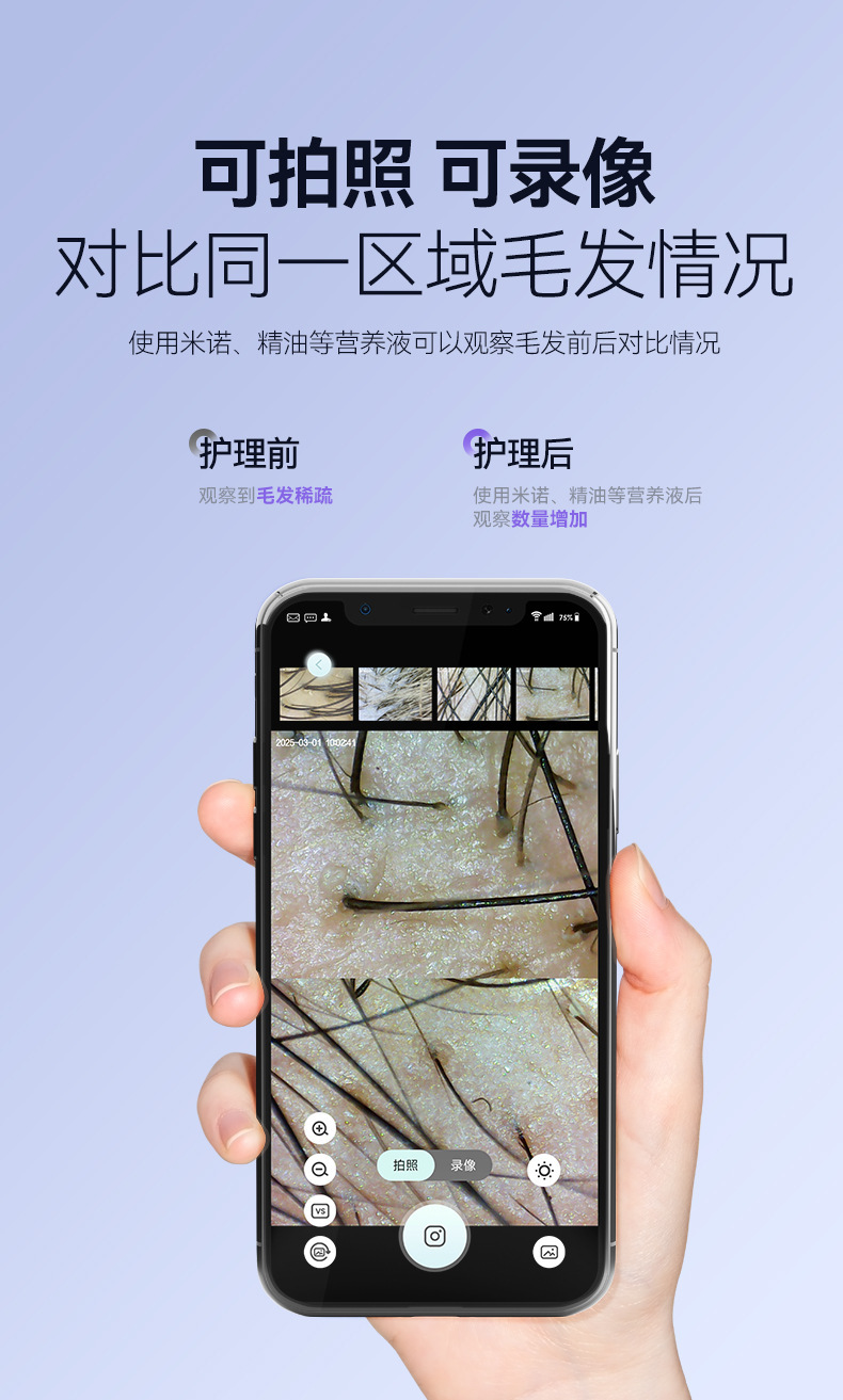 新品精准头皮检测仪高清便携家用美容院养发馆毛囊皮肤检测仪器 6