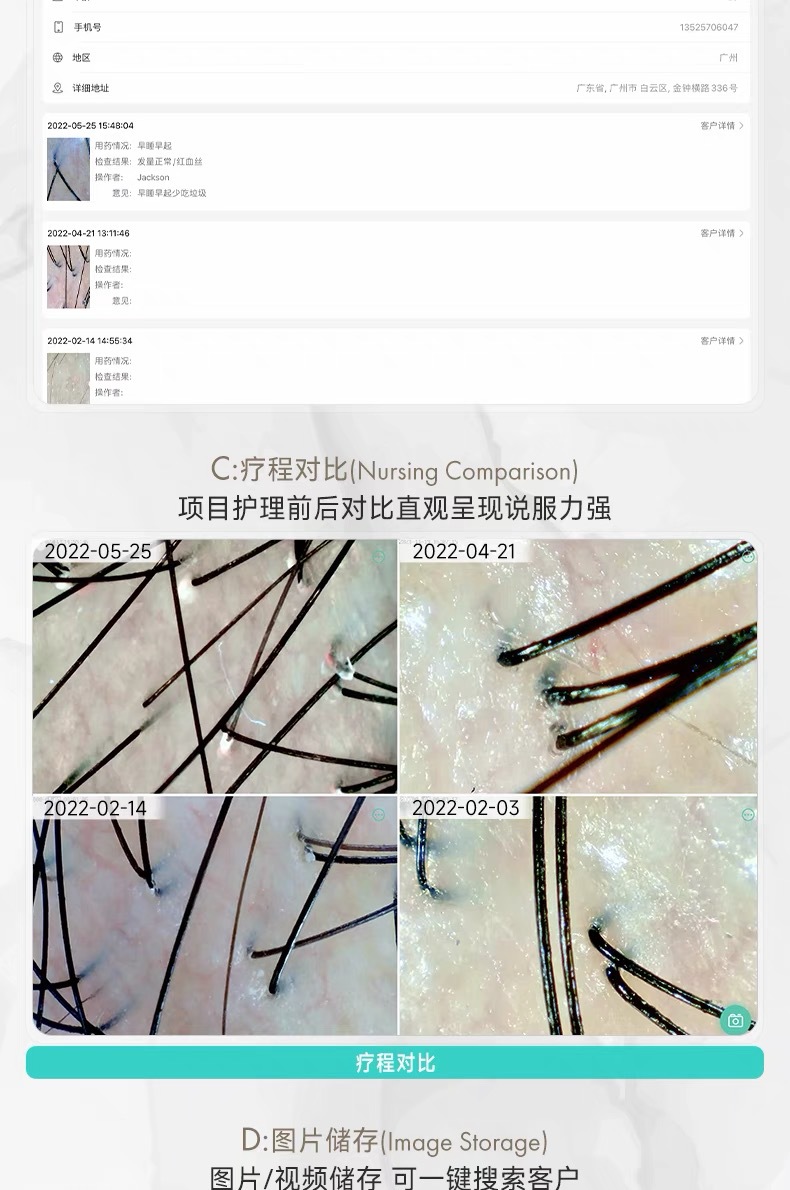 美博艺头皮检测仪毛囊高清面部皮肤检测仪美容院无线便携式测试仪 4