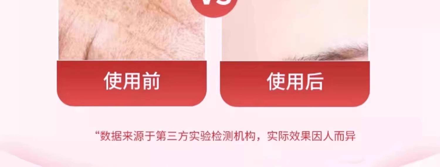 川字纹贴告别皱纹紧致提拉改善淡化法令纹眼角纹舒展皱纹美容贴 8