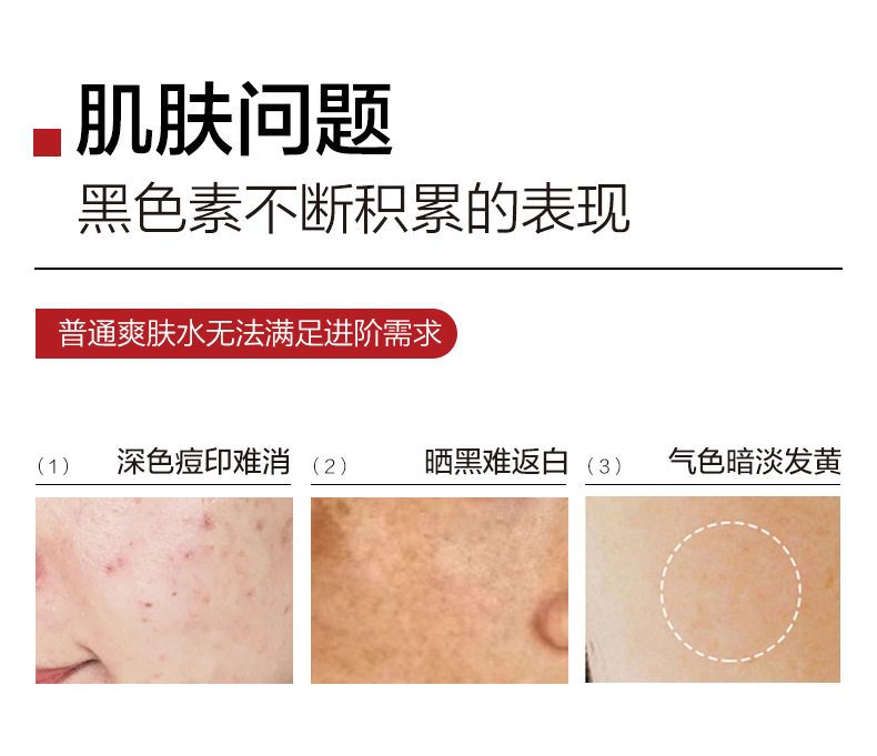 美容院熊果苷精华原液保湿焕亮美肌淡化补水无针水光精华液12瓶装 3