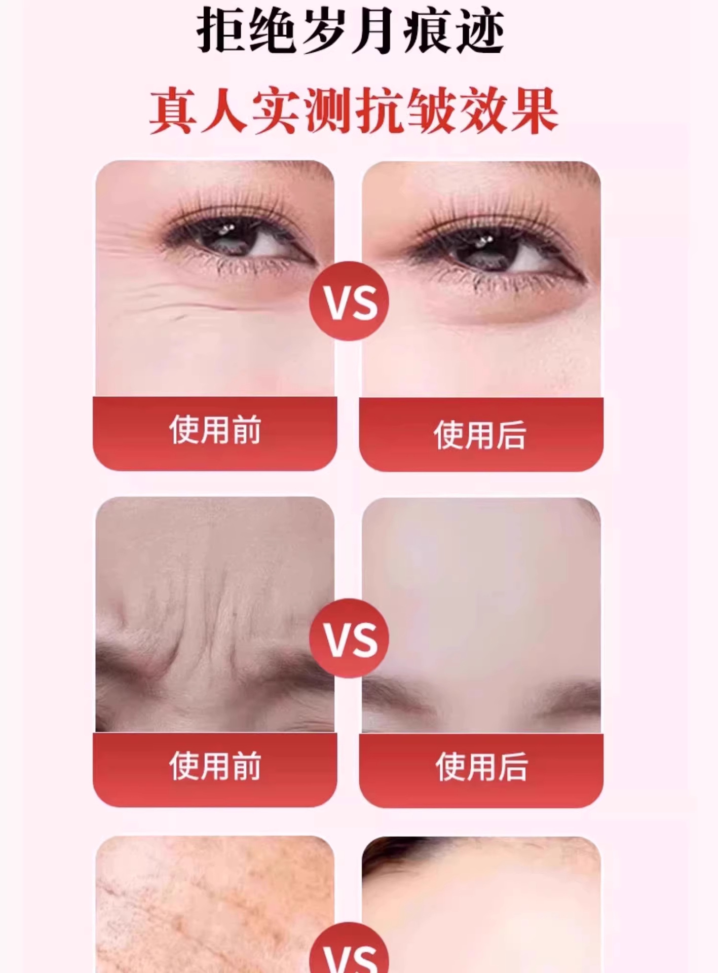 川字纹贴告别皱纹紧致提拉改善淡化法令纹眼角纹舒展皱纹美容贴 7