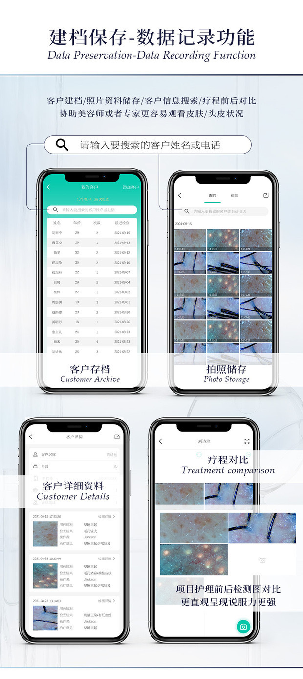 头皮检测仪毛囊高清美容仪白转黑养发馆专用面部皮肤测试美容院四 5