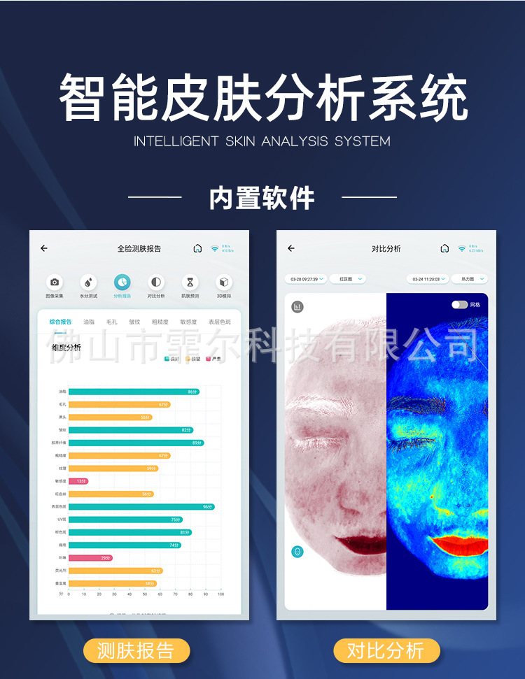 工厂直销AI智能测肤仪吉利猫外贸款肌肤全脸分析皮肤健康设备跨境 5