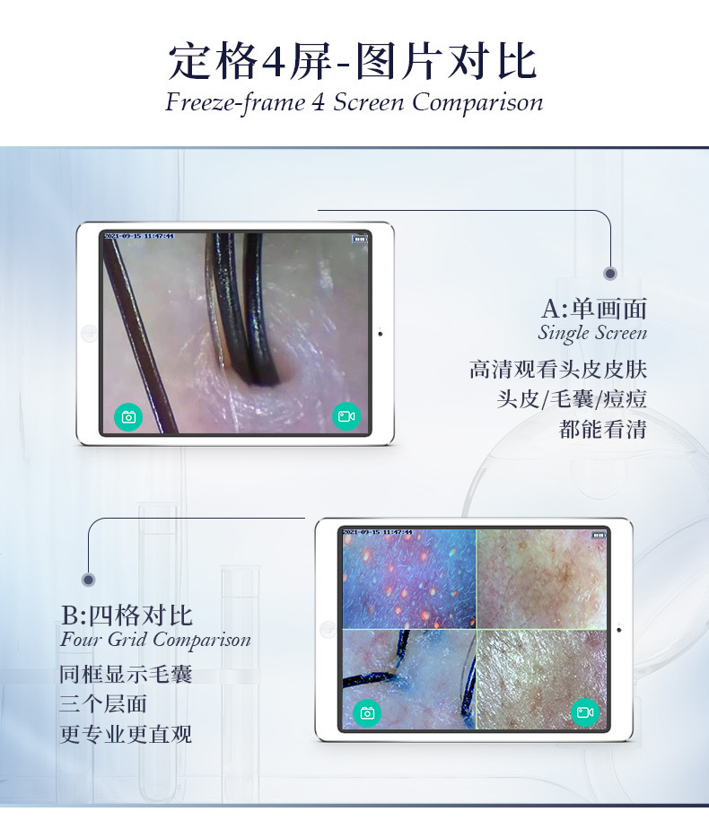 头皮检测仪毛囊高清美容仪白转黑养发馆专用面部皮肤测试美容院四 10