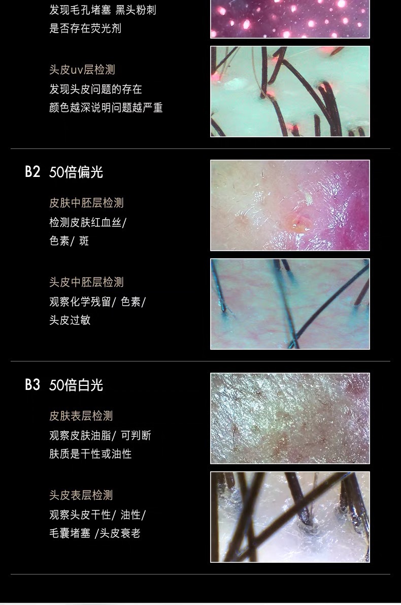 美博艺头皮检测仪毛囊高清面部皮肤检测仪美容院无线便携式测试仪 7