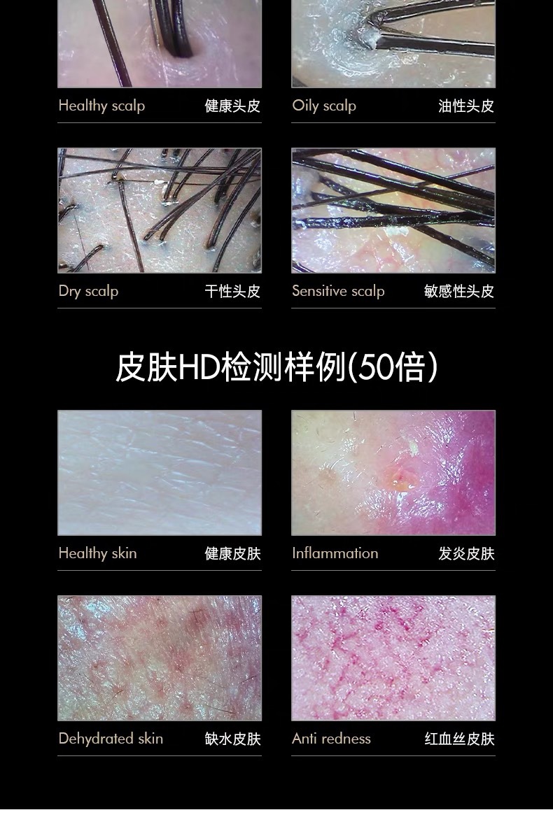 美博艺头皮检测仪毛囊高清面部皮肤检测仪美容院无线便携式测试仪 9