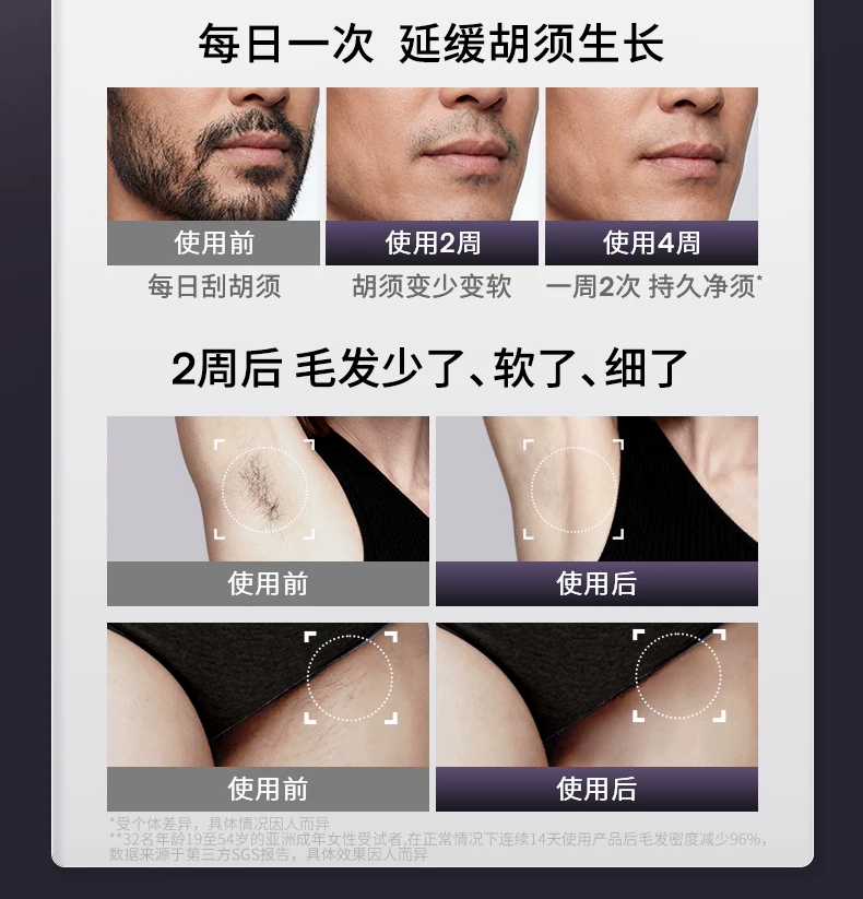 [智能脱毛]Ulike蓝宝石冰点脱毛仪器Pro10S医用院线级无痛神器女 18