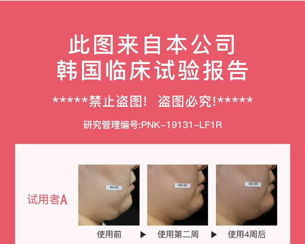爱满分瘦脸仪v脸神器微电流美容仪器家用脸部面部按摩仪瘦脸神器 14