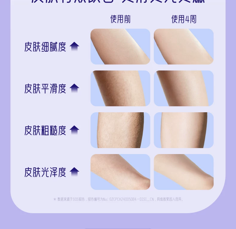 19.8J大能量】奥克斯冰点蓝宝石脱毛仪家用全身学生党私处唇腋毛 14