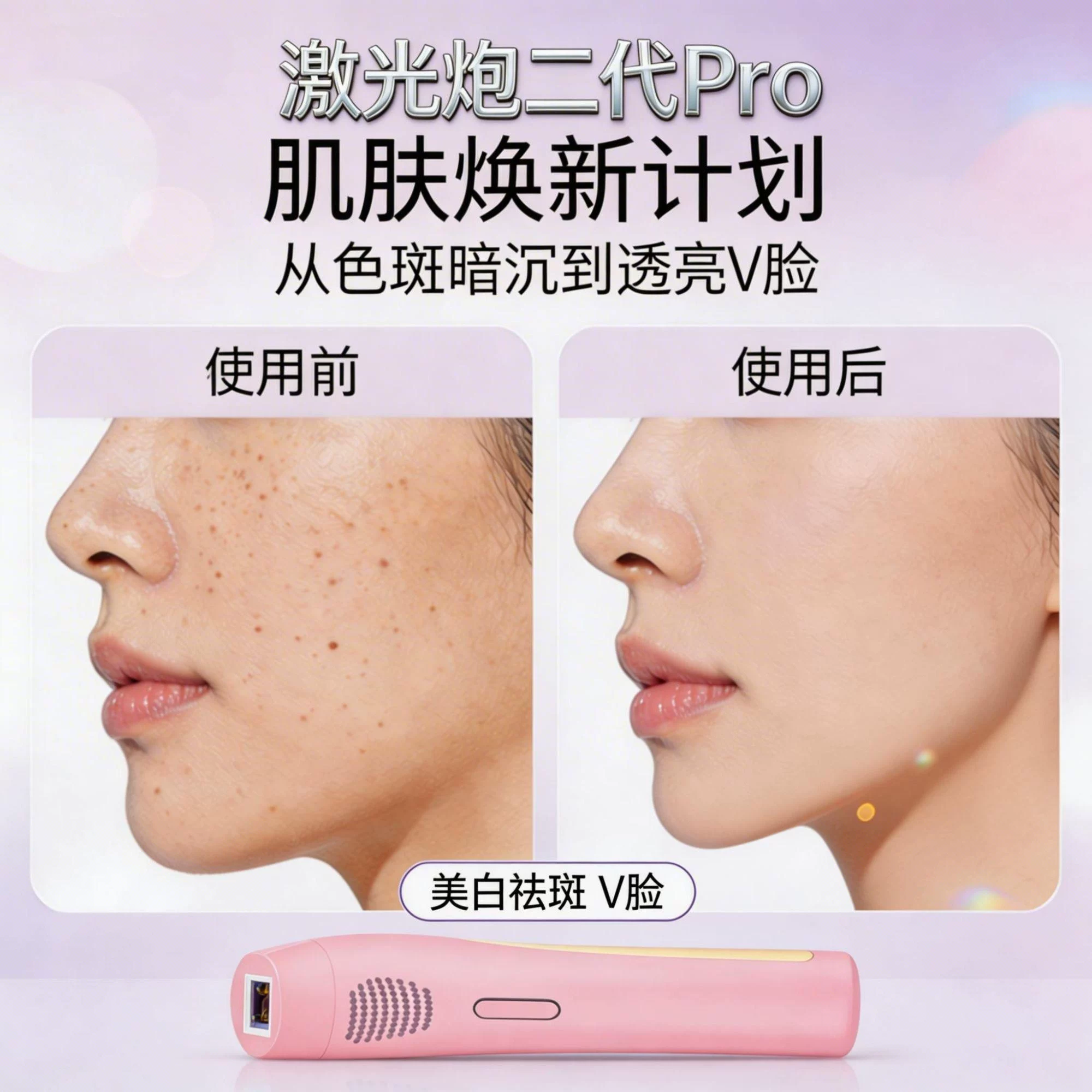 专柜韩国多俊二代激光炮Pro淡斑v脸紧致美白美容仪专注激光16年 11