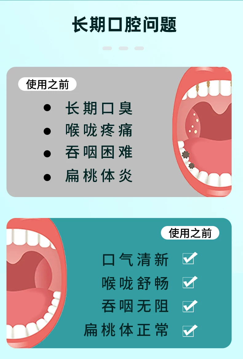 扁桃体结石去除工具隐窝可视吸取器口腔喉咙掏取挖勺家用祛除神器 6