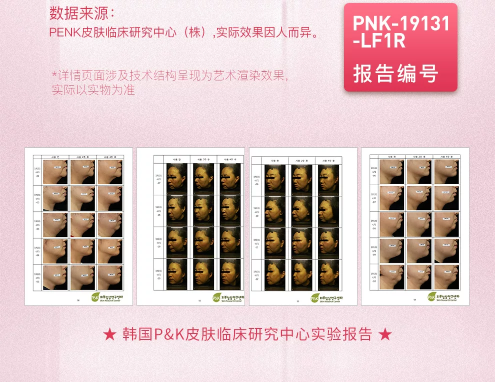 爱满分瘦脸仪v脸神器微电流美容仪器家用脸部面部按摩仪瘦脸神器 8