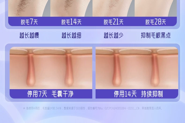 19.8J大能量】奥克斯冰点蓝宝石脱毛仪家用全身学生党私处唇腋毛 11