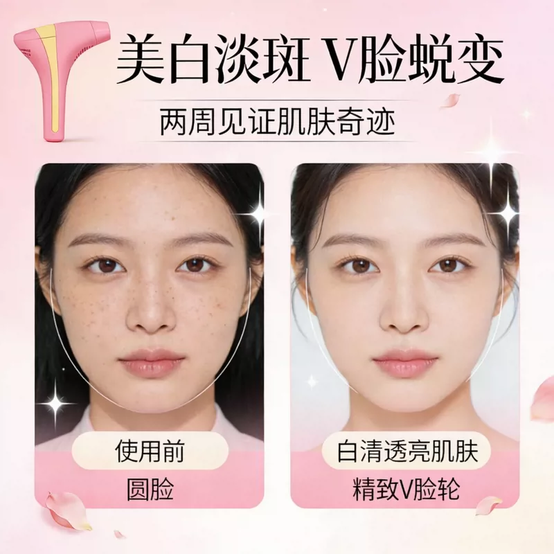 专柜韩国多俊二代激光炮Pro淡斑v脸紧致美白美容仪专注激光16年 12