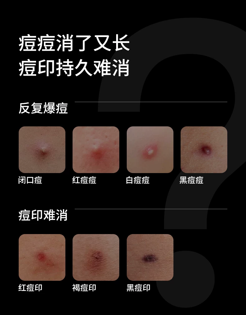 【曹颖甄选】AMIRO觅光面罩L2 Pro美容仪LED光疗红蓝光祛痘嫩肤仪 4